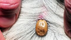 klíště, klíšťata, encefalitida