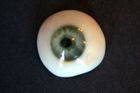Oční protéza z 3D tiskárny
