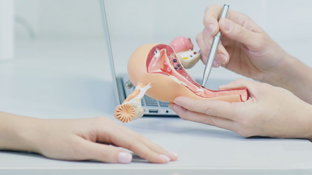 Vaginoplastika umí řešit i problémy s inkontinencí