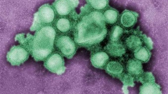 Snímek viru prasečí chřipky, pořízený v laboratoři v Atlantě.