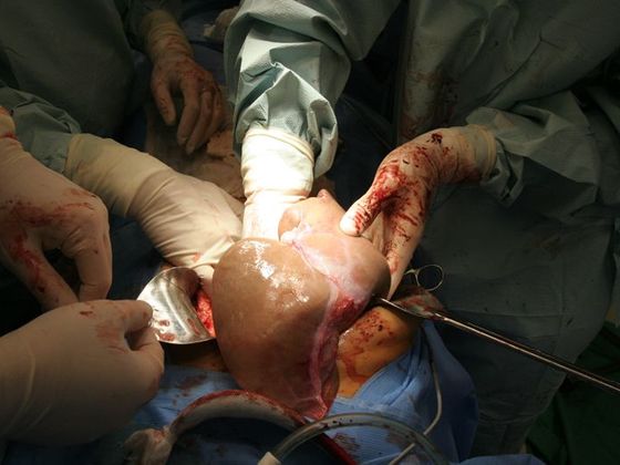 Čtěte více k tématu: Transplantace jater