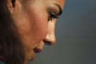 Nový hit plastik: Američanky chtějí nos vévodkyně Kate