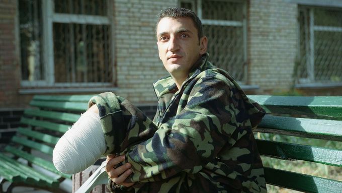 Boje na východě Ukrajiny od roku 2014 pokračují a řada vojáků i dobrovolníků si z nich odnesla těžká zranění.