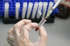 Vloni v ČR přibylo nejvíce nakažených HIV od roku 1985