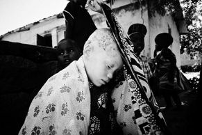 Afričtí albíni, vězni temnoty. Polský fotograf Michał Szalast popisuje, jak žijí