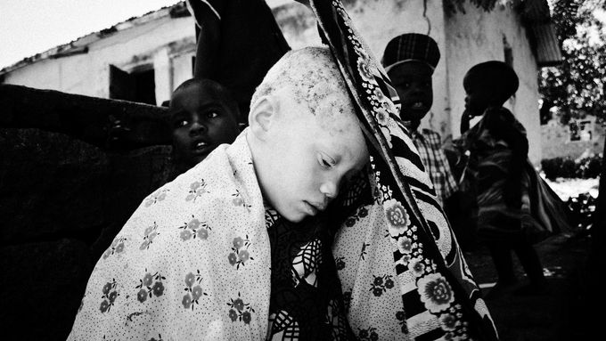 Afričtí albíni, vězni temnoty. Polský fotograf Michał Szalast popisuje, jak žijí