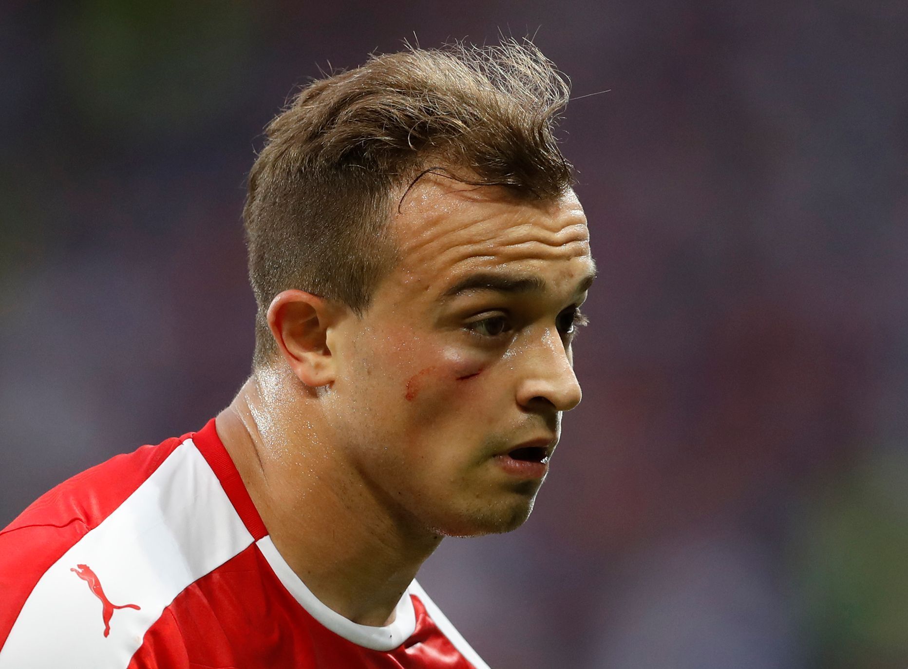 Euro 2016, Švýcarsko-Francie: zraněný Xherdan Shaqiri