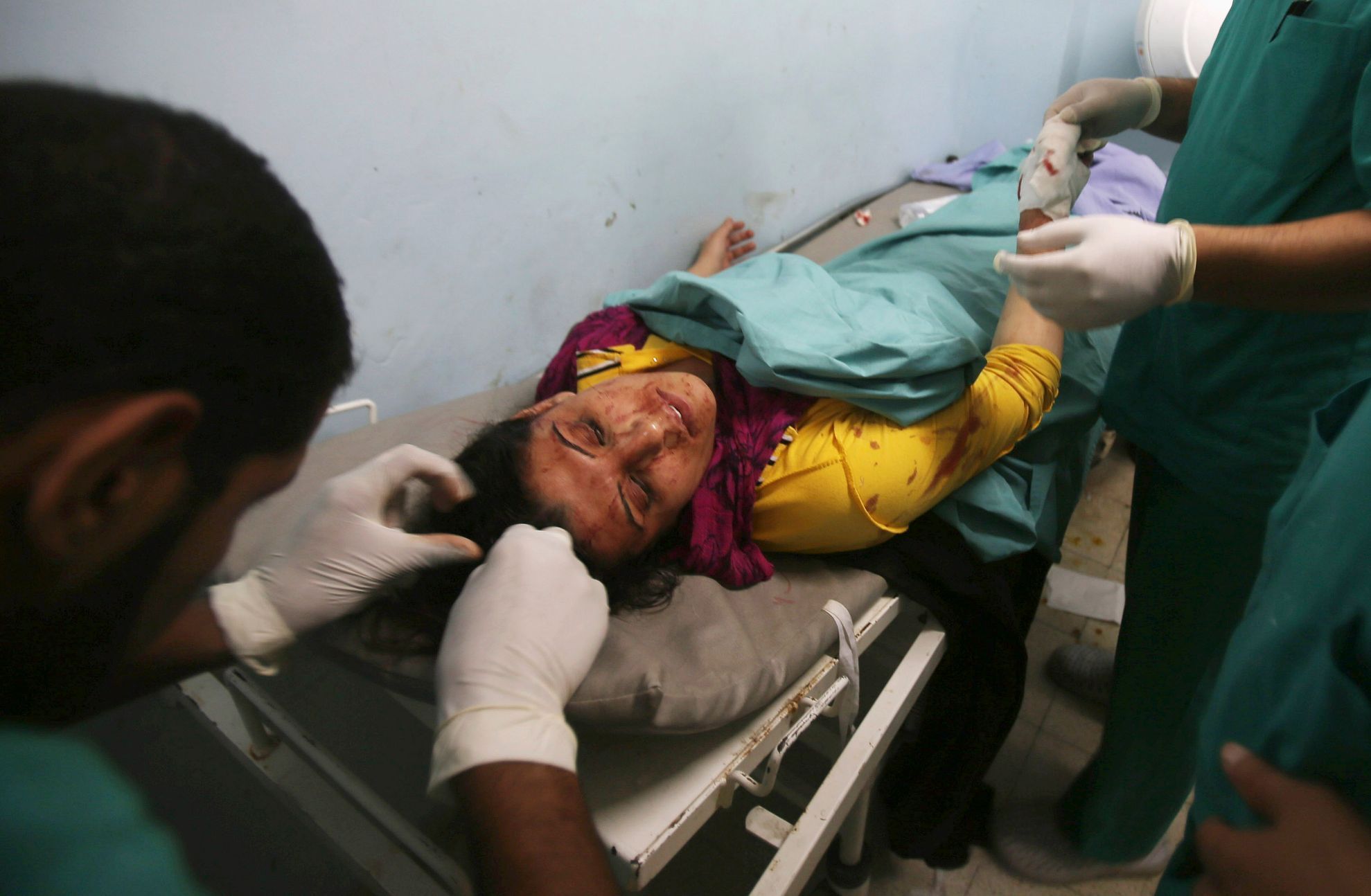 žena - izrael - palestina - gaza - zranění - nálet