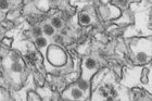 Čtvrtý případ viru zika v Česku. Nakažená žena se vrátila z Martiniku