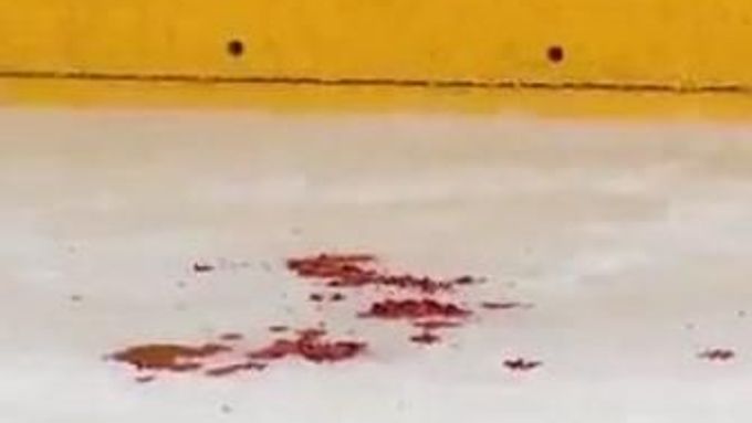 Hokejista Blake Geoffrion z Montralu Canadiens je po operaci prasklé lebky. Nepříjemné zranění utrpěl po tvrdém hitu soupeře v utkání AHL.