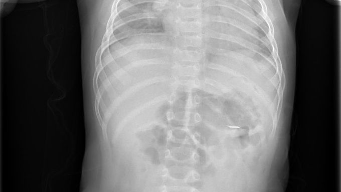 Lékaři apelují na rodiče a další dospělé, aby produkty pro užívání zahřívaného tabáku uchovávali vždy mimo dosah dětí.