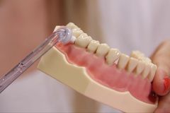 Smršť injekcí a osm zubů najednou. Francie soudí "zubaře hrůzy", který zničil chrup stovce lidí