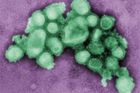 H1N1: V Praze zemřel pacient. Cheb má 270 podezřelých