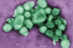 Střední Čechy hlásí 40 případů H1N1, 5 je v nemocnici