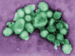 Snímek pořízený transmisním elektronovým mikroskopem (TEM) ukazuje vnitřní strukturu viru prasečí chřipky H1N1.