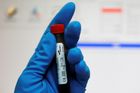 WADA předloni registrovala 1595 pozitivních dopingových testů