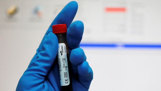 Vzorek krve italského kulturisty dopingové komisaře šokoval