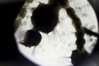 Nejnovější studie: Virus zika může způsobovat dočasnou paralýzu
