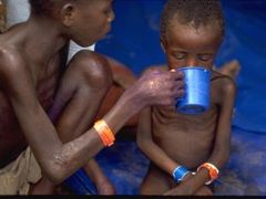 Žalostně nízká podpora rozvinutých zemí stále znemožňuje účinnou a rozsáhlou léčbu dětské podvýživy, která je ročně příčinou úmrtí téměř 5 milionů dětí mladších 5 let.