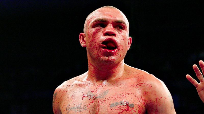 Hrozivá zranění v boxerské historii (Rodrigo Barrios)
