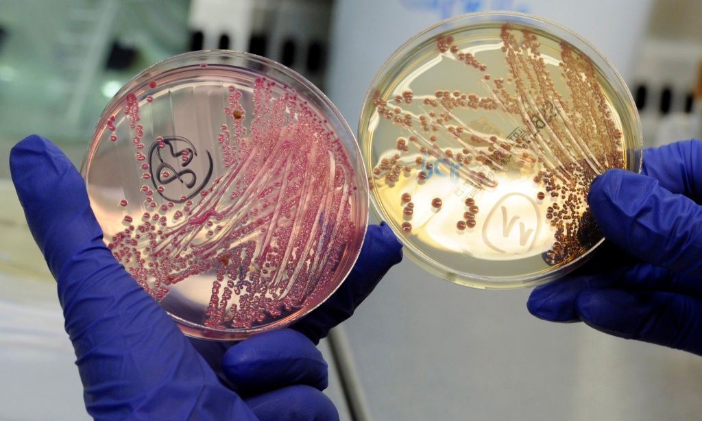 Baktérie E.coli na eppendorfské klinice 2
