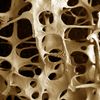 Tělo - osteoporóza