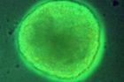 Kmenové buňky mohou být hledači nádorů, ukázali vědci