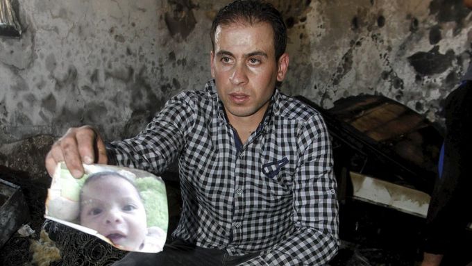 Snímek hocha, který se stal obětí židovských extremistů.