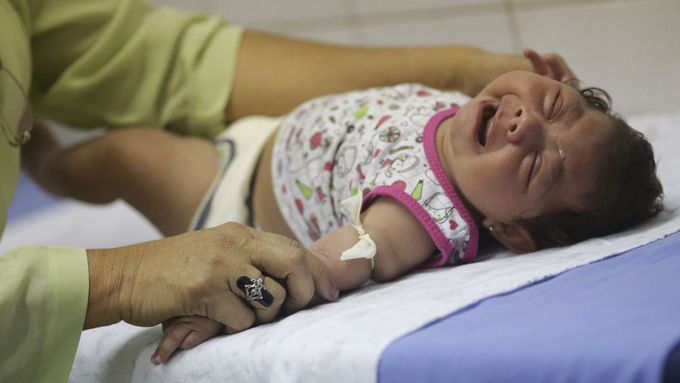 Virus zika způsobuje zakrnění mozku novorozenců.