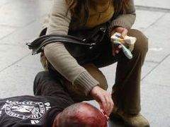 Žena se na ulici v Bělehradu snaží ošetřit jednoho ze zraněných po potyčkách odpůrců homosexuálů s policejními těžkooděnci.