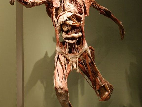 Plastinace