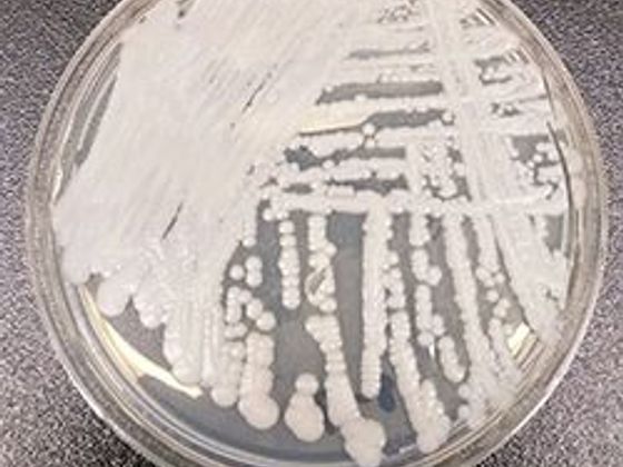 Candida auris Candida auris