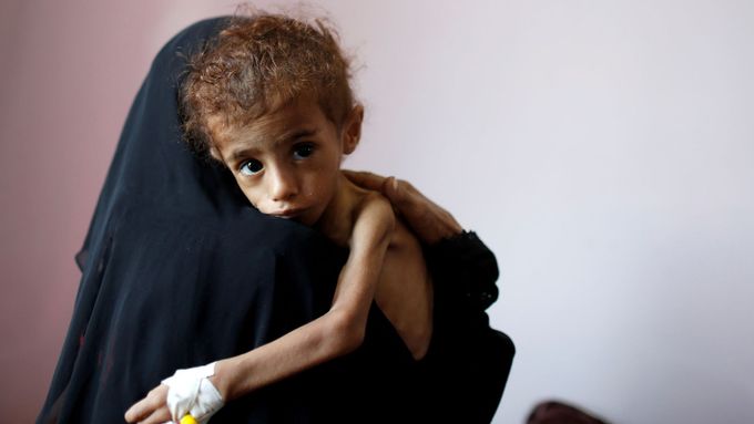 Hladomor v Jemenu - ilustrační foto.