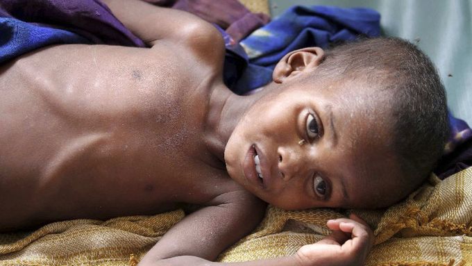 Somálsko decimuje hladomor, úrodu ničí sucha