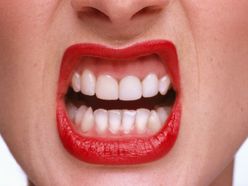 Bílé zuby