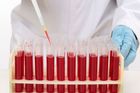 Vědci našli genetickou nemoc krve, zvyšuje riziko leukémie