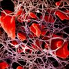 Tělo - shluk krevních sraženin kolem červených krvinek