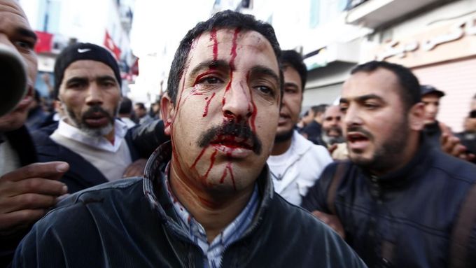 Muž, zraněný při bitce mezi odboráři a stoupenci vládní strany An-Nahda.