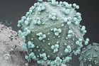 Vědci ukázali prstem: HIV pochází z Kinshasy