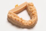 Zubní náhrady – Nová technologie byla převratná i pro zdravotnictví. Například v oboru stomatologie mohou zdravotníci využívat modely korunek, můstků či zubních implantátů.