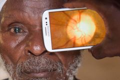 Boj proti slepotě. Oční vady nově odhalí mobilní aplikace