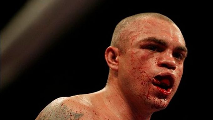 S utrženým rtem odešel Rodrigo Barrios ze svého zápasu s Rockym Juarezem. Nebyl sám, kdo si odnesl z boxerského zápasu hrozivé zranění.