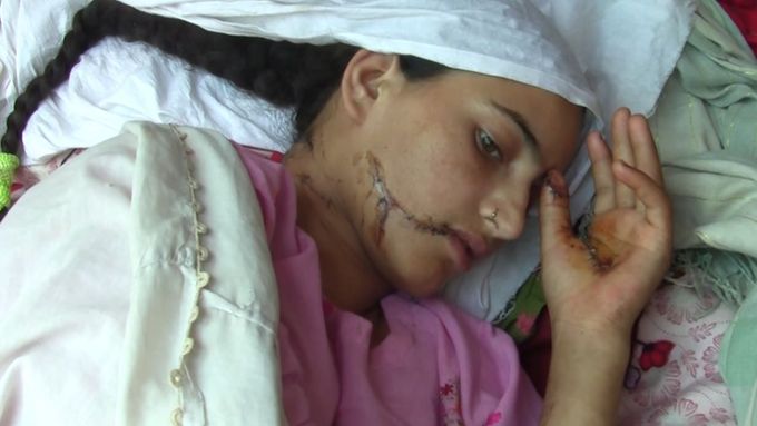 Vraždy ze cti jsou v Pákistánu i nadále velmi rozšířené. Oběti bývají většinou ženy, které se měly podle příbuzných dopustit poškození pověsti rodiny.