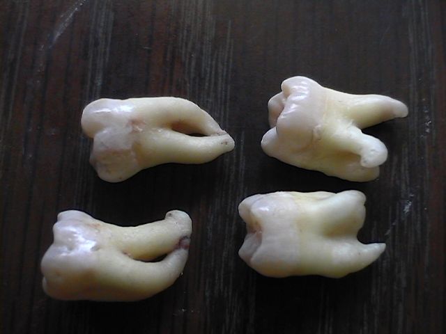 Vytržené zuby