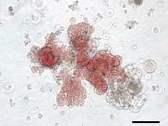 Kmenové buňky pod mikroskopem.