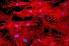Výzkum: Infarktem zmoženému srdci uleví kmenové buňky