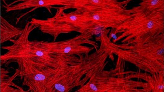 Srdeční svalstvo pod fluorescenčním mikroskopem - červeně jsou znázorněny myofibrily (základní jednotka svalového vlákna), modře jádra buněk