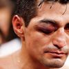 Hrozivá zranění v boxerské historii (Erik Morales)