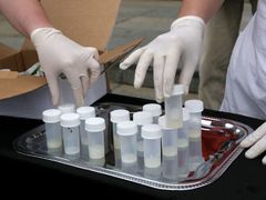 Papírová krabice na černém stolku ukrývala více než dvacet vzorků spermatu od dobrovolných dárců.