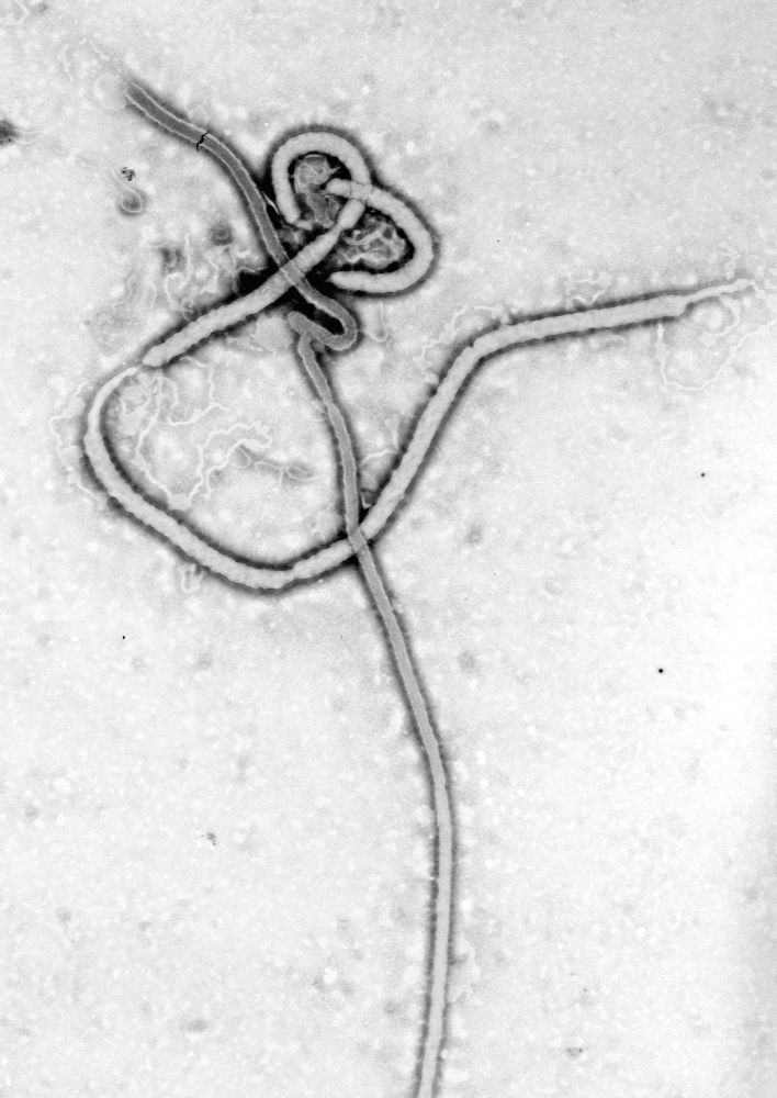 Virus Eboly